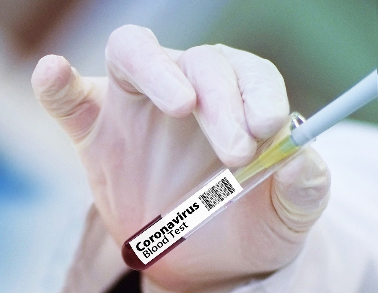 Лаборатория "Хеликс" начала делать тесты на коронавирус. Или нет? Можно ли пройти тест в Сосновом Бору